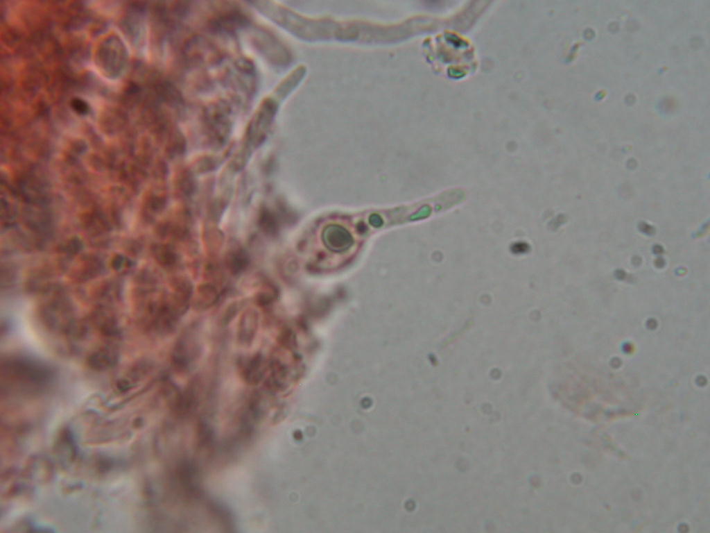 Da determinare...!!! (Radulomyces molaris)